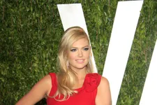 Kate Upton Leaves Massive Bruise On “The Other Woman” Costar!