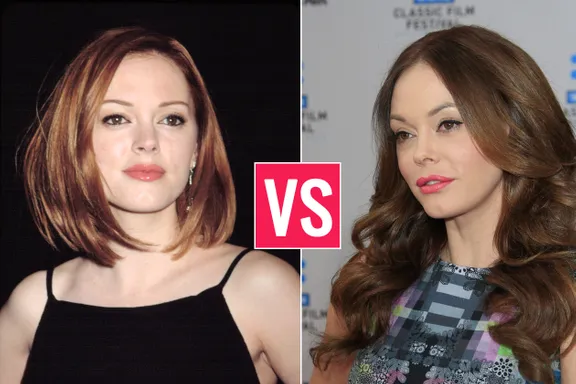 Celebrities With Plastic Surgery: Better Before Or After?
