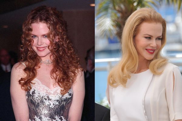 17 Celebs Who Looked Better Before Plastic Surgery