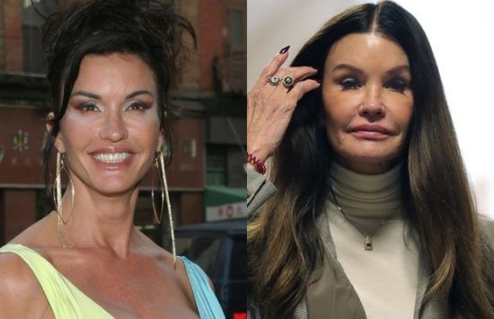 17 Celebs Who Looked Better Before Plastic Surgery - Fame10